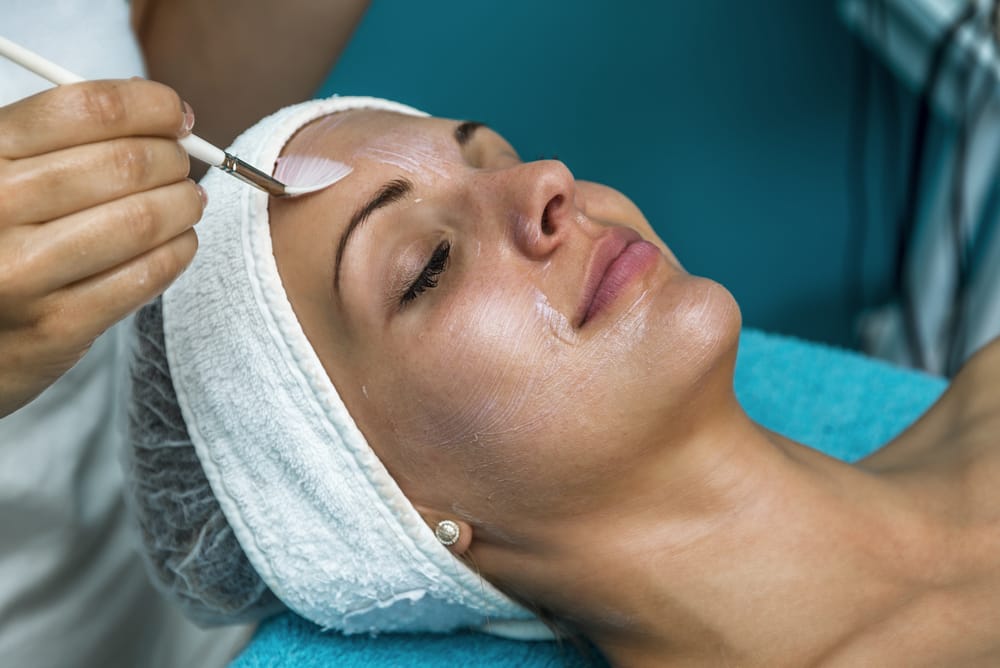 chemical peels