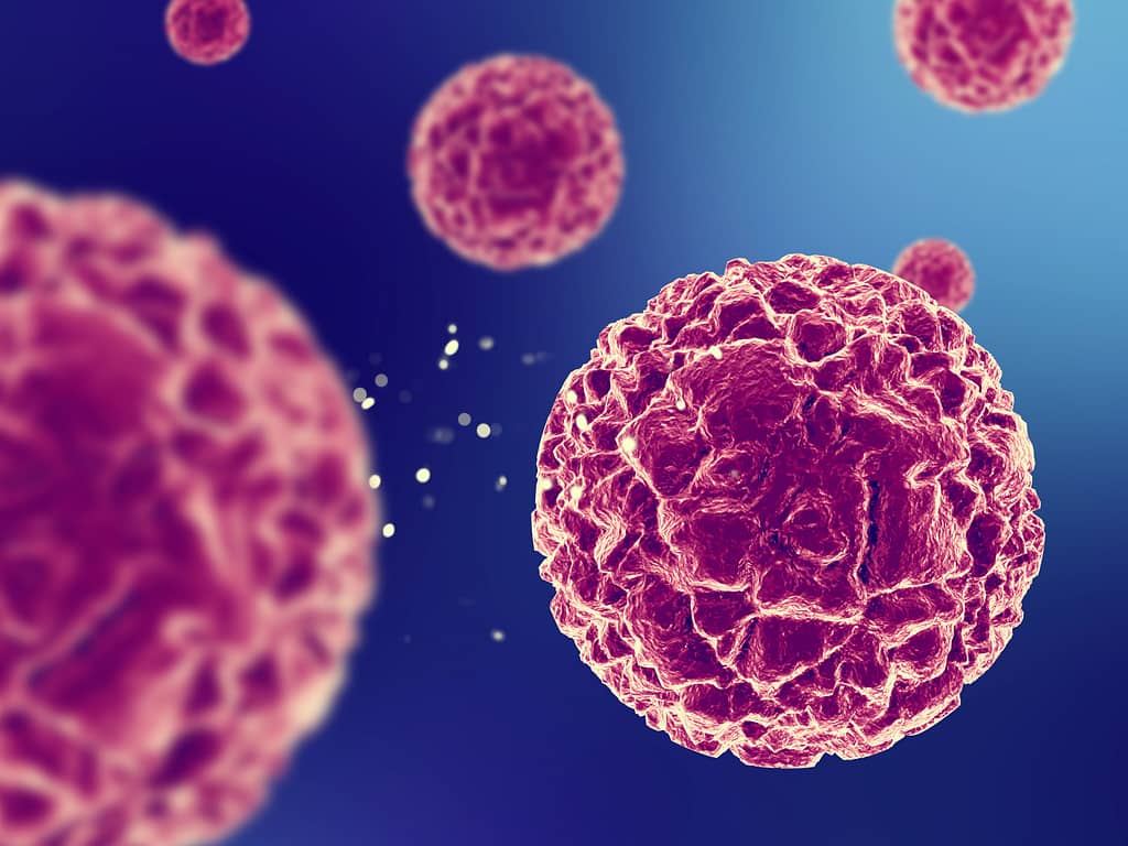 Soft Tissue Tumors: Early Diagnosis & Safe Removal by a Skilled Cosmetic Plastic Surgeon