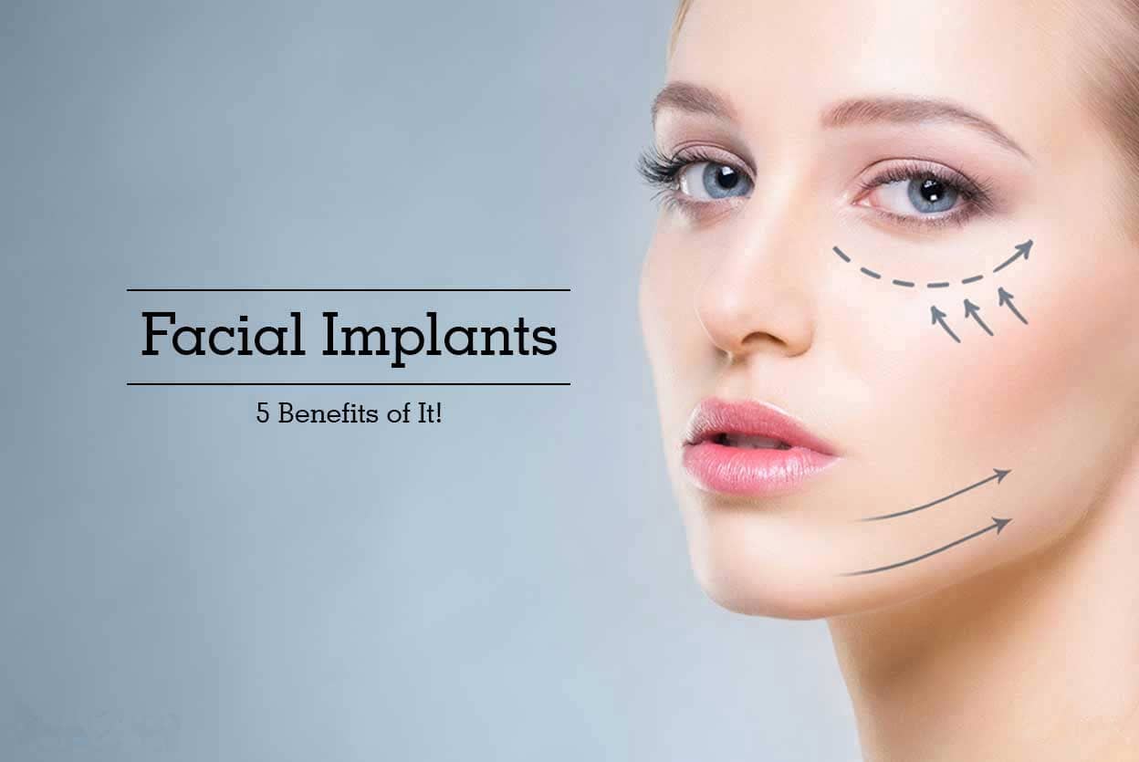 Facial Implants Benifits