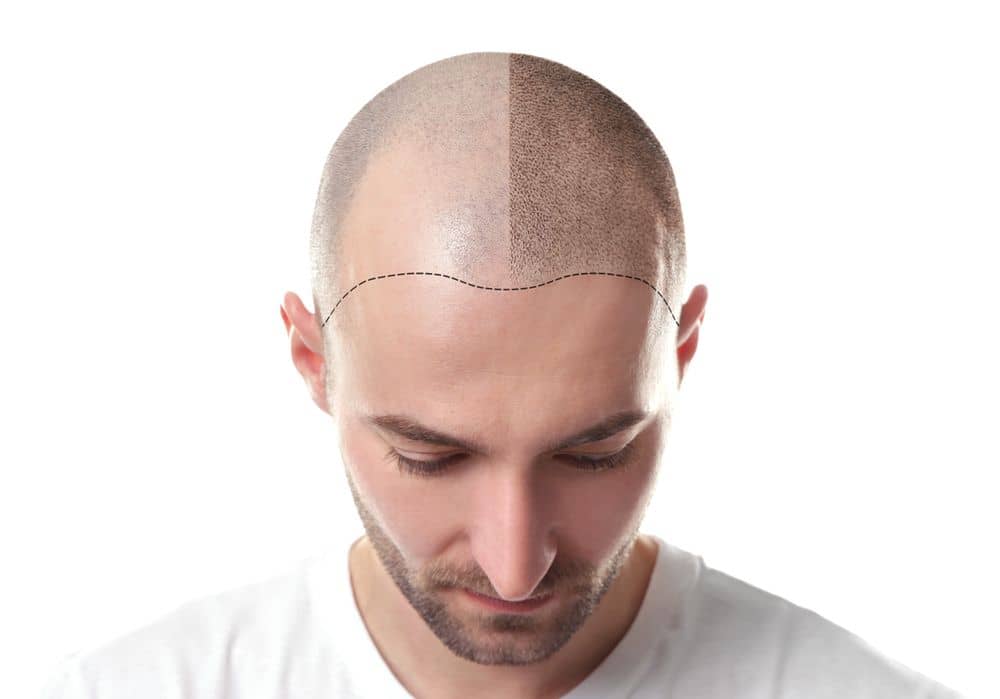 Elegance Skin & Cosmetic Clinic - Best Plastic Surgeon & Skin Specialist in Ahmedabad (INDIA)